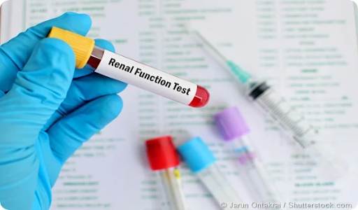 Kidney Function Tests